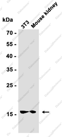 Recombinant Ubiquitin Conjugating Enzyme E2 L3 Monoclonal Antibody - 1