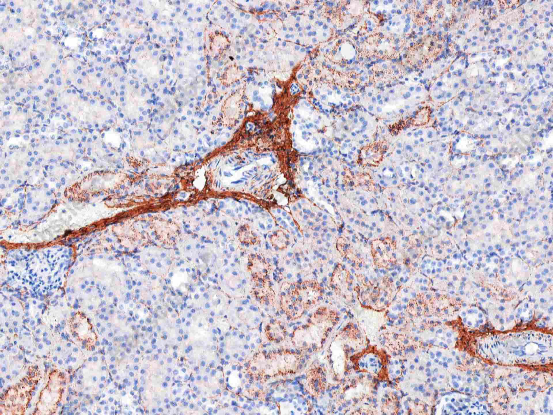 Recombinant Collagen I Monoclonal Antibody - 1