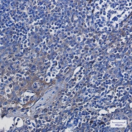 Recombinant ENO1 Monoclonal Antibody - 4