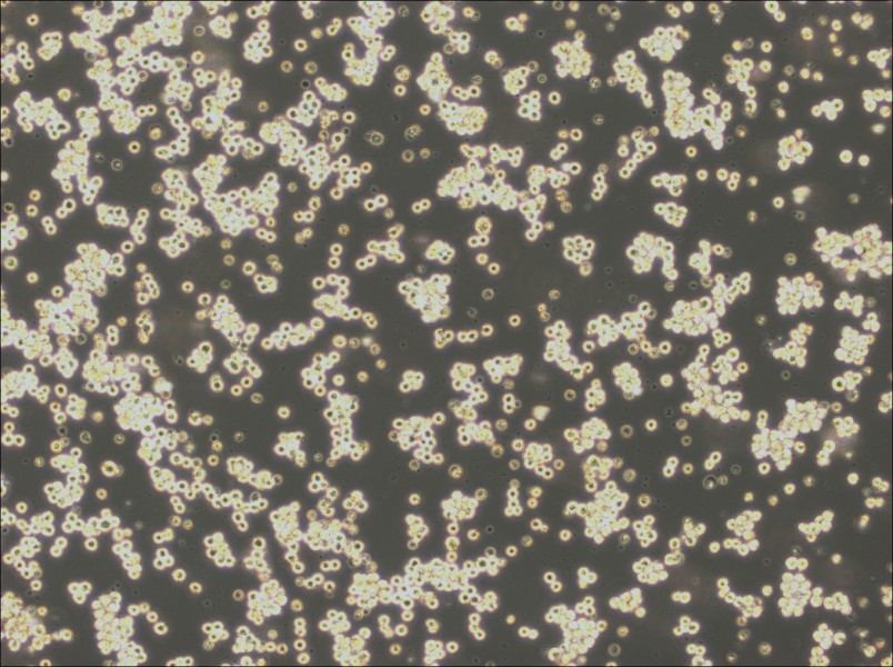 Akata Cell Complete Medium - 3