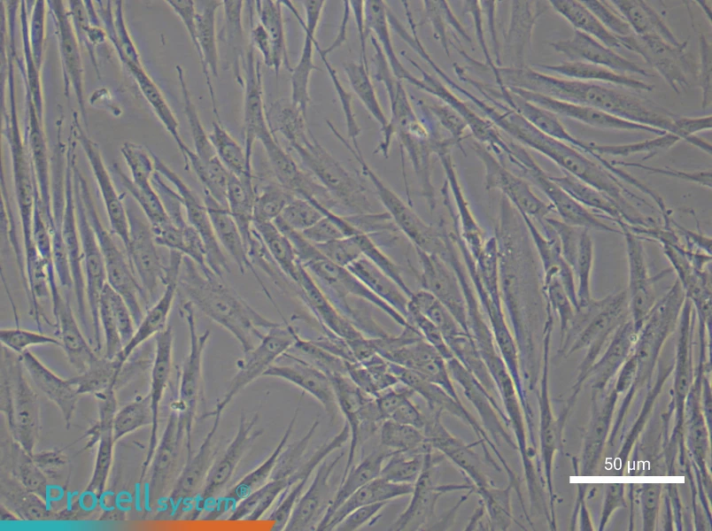 Human Skeletal Muscle Fibroblast Complete Medium - 5
