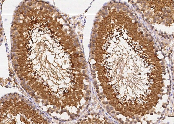 Recombinant UCHL3 Monoclonal Antibody-searchlist-1