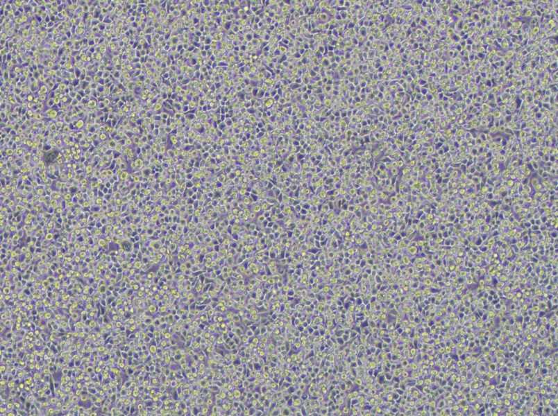 WEHI-3 Cell Complete Medium - 2