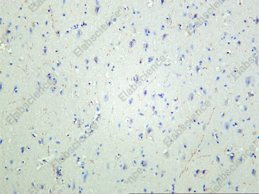 Recombinant TH/Tyrosine Hydroxylase Monoclonal Antibody - 2