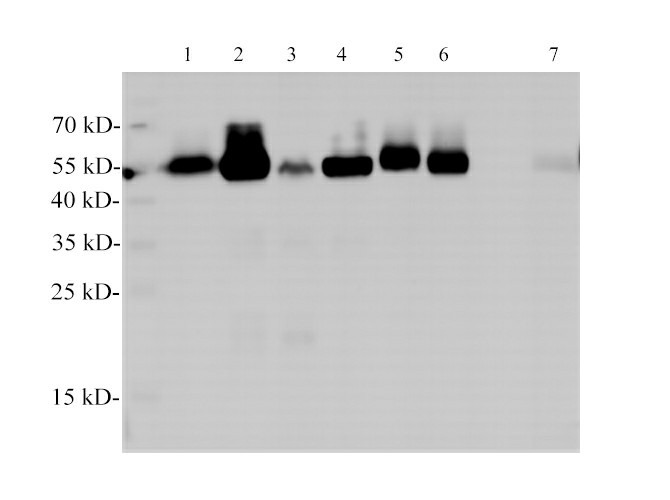 Western Blotting with anti-TUBA monoclonal antibody at dilution of 1:2000.
Lane 1: Hela cell lysates, Lane 2:jurkat cell lysates, Lane, 3: 293T lysates, Lane 4: MCF-7 cell lysates, Lane 5: HT-29 cell lysates, Lane 6:HepG2 cell lysates, Lane 7:Rat kidney lysates