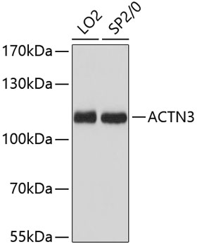 Western blot analysis of extracts of various cell lines using ACTN3 Polyclonal Antibody at 1:3000 dilution.