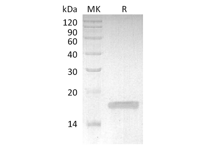 Recombinant Rabbit TNF-alpha/TNFSF2/TNFa Protein