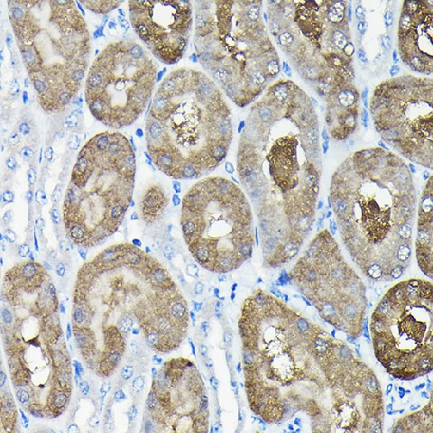 Immunohistochemistry of paraffin-embedded mouse kidney using TCP1 Polyclonal antibody at dilution of 1:100 (40x lens).Perform high pressure antigen retrieval with 10 mM citrate buffer pH 6.0 before commencing with IHC staining protocol.