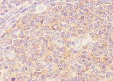Recombinant NF-kB2 p100/p52 Monoclonal Antibody-searchlist-2