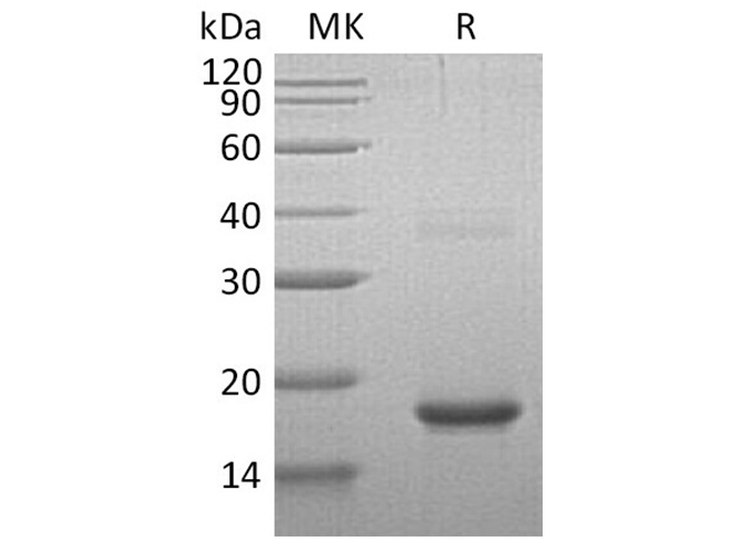 Recombinant Human Cornulin/CRNN Protein (His Tag)