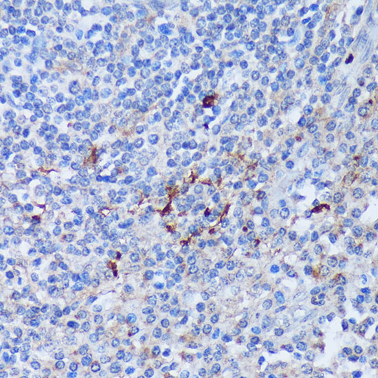 Immunohistochemistry of paraffin-embedded Human tonsil using PADI4 Polyclonal Antibody at dilution of  1:100 (40x lens).