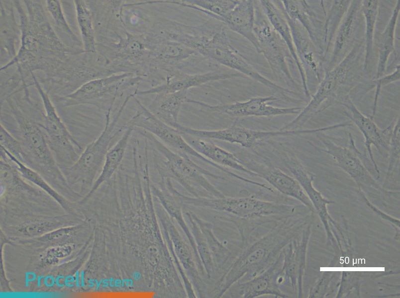 Human Aortic Adventitial Fibroblast Complete Medium - 6