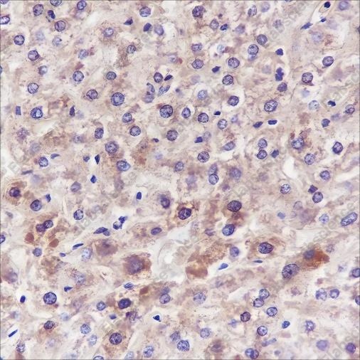 Recombinant ANGPTL3 Monoclonal Antibody - 2