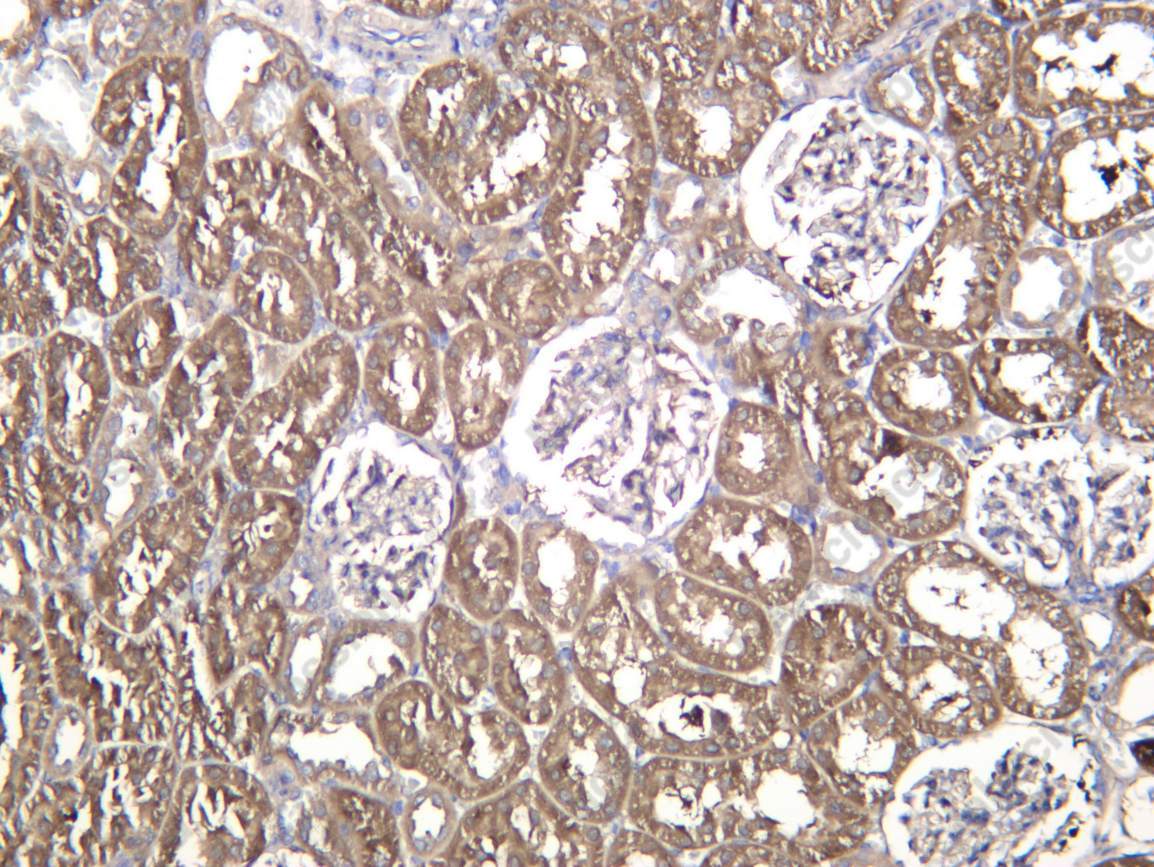 Recombinant AP2A1 Monoclonal Antibody - 3