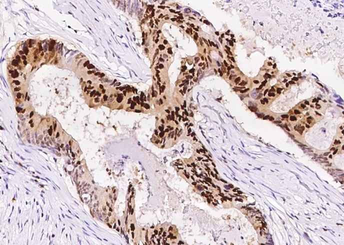 Recombinant PCNA Monoclonal Antibody - small - 3