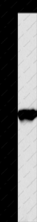PPP3CA Polyclonal Antibody - 1
