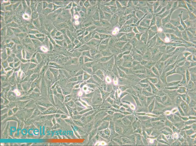 9L/lacZ Cell Complete Medium - small - 4