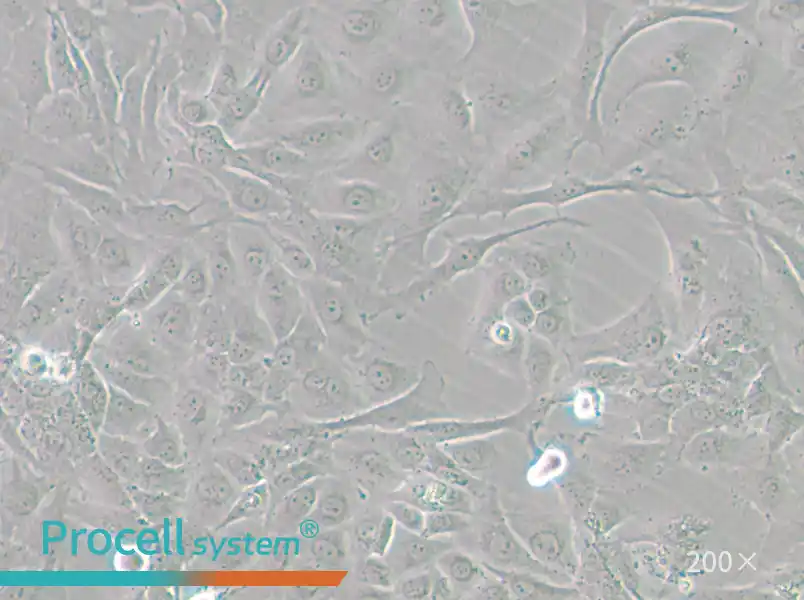 J82 Cell Complete Medium - small - 5