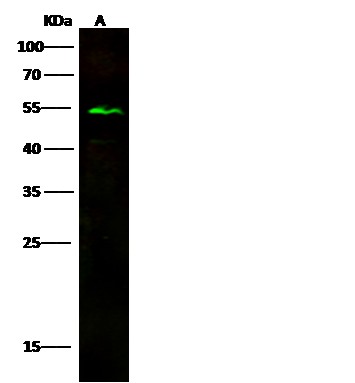 Recombinant ENTPD5 Monoclonal Antibody - small - 5