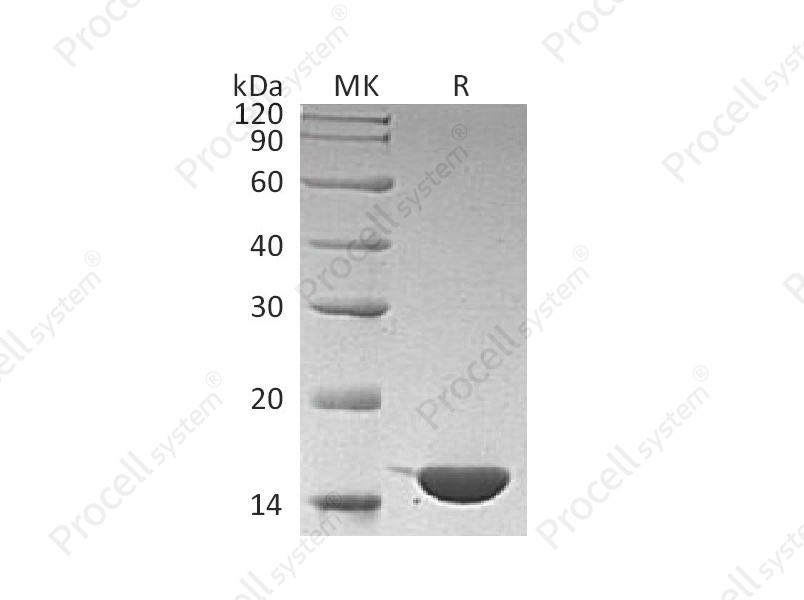 IL-36&gamma;/IL-1F9, Human, Recombinant