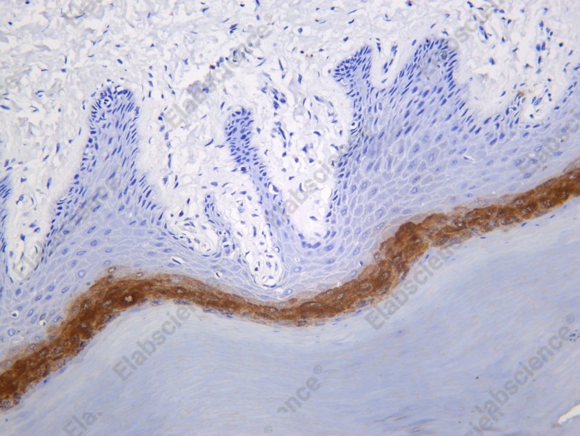 Recombinant Loricrin Monoclonal Antibody - 1