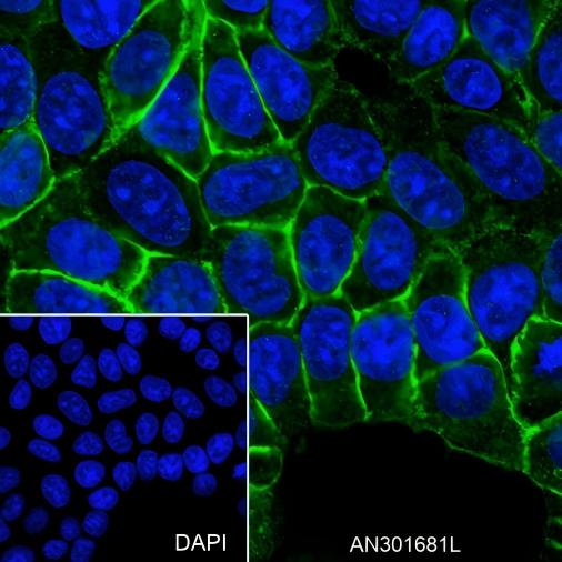 Recombinant TROP2 Monoclonal Antibody - small - 5