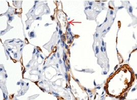 Recombinant CD146/MCAM Monoclonal Antibody - small - 3