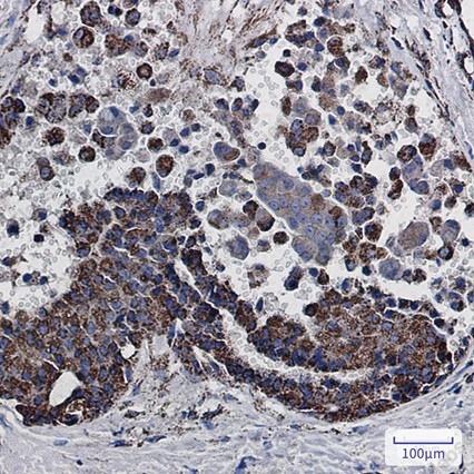 Recombinant MDH2 Monoclonal Antibody - 2