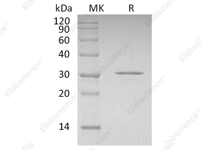 Recombinant Human CDKN1B Protein (His Tag) - 1