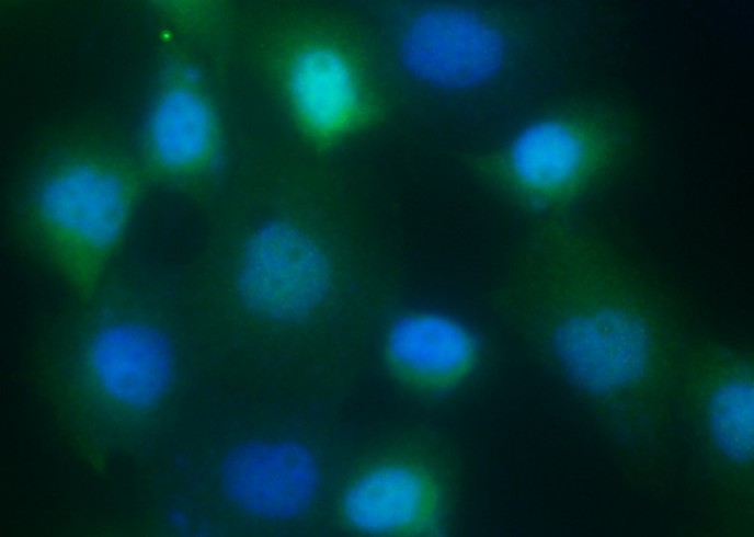 S100A9 Monoclonal Antibody - small - 2