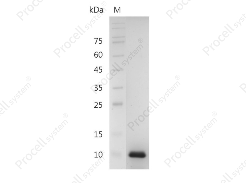 IL-8/MDNCF/NAF/CXCL8, Human, Recombinant