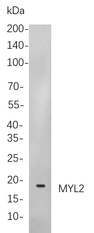 Recombinant Myosin Light Chain 2 Monoclonal Antibody-searchlist-1