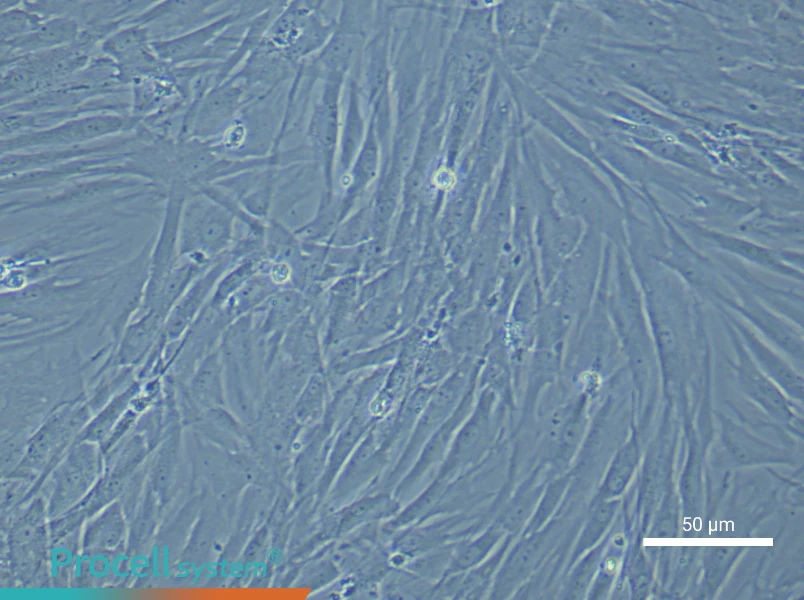 Human Pulmonary Artery Smooth Muscle Cell Complete Medium - 4