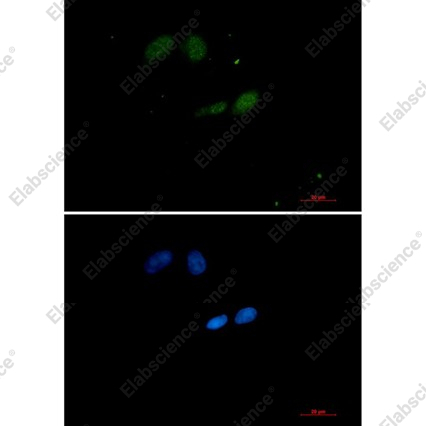 Recombinant SUMO Conjugating Enzyme UBC9 Monoclonal Antibody - 3
