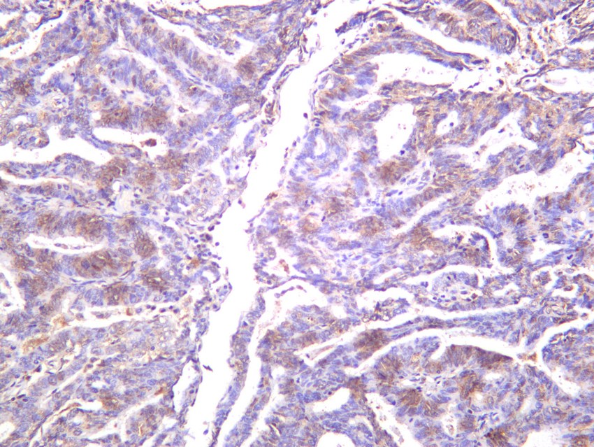 Recombinant Phospho-mTOR (Ser2448) Monoclonal Antibody - small - 5