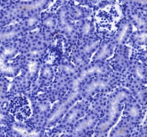 Recombinant FABP7 Monoclonal Antibody - small - 4