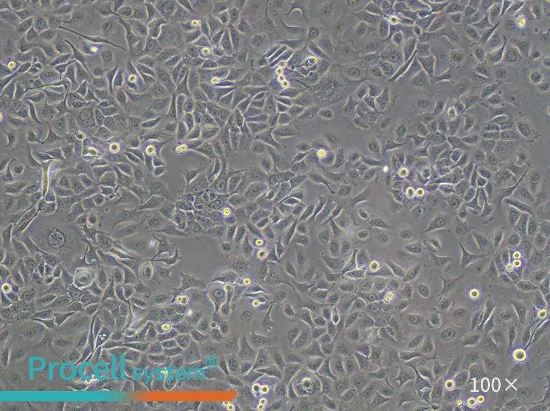 HCC 94 Cell Complete MediumHCC 94 Cell Complete Medium - 2