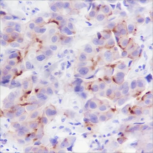 Recombinant Phospho-Girdin (Tyr1765) Monoclonal Antibody-searchlist-1
