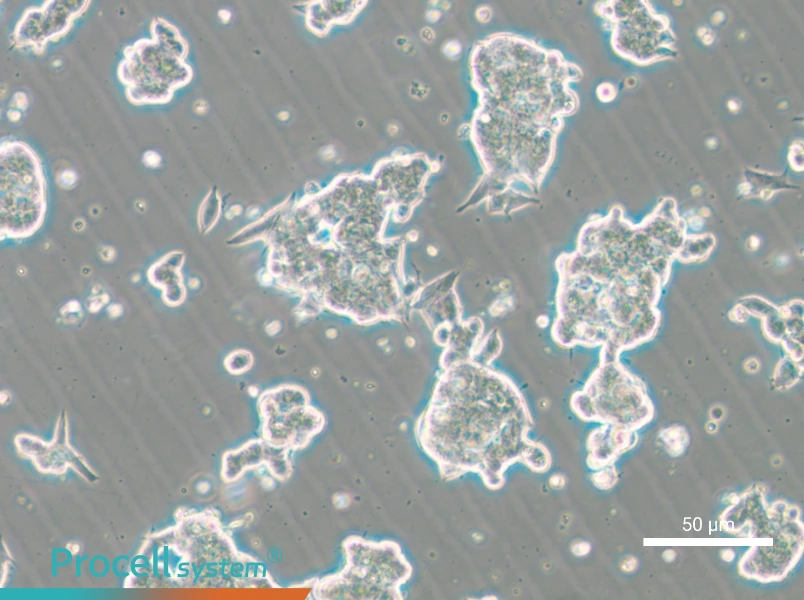 NCI-H209 [H209] - 4