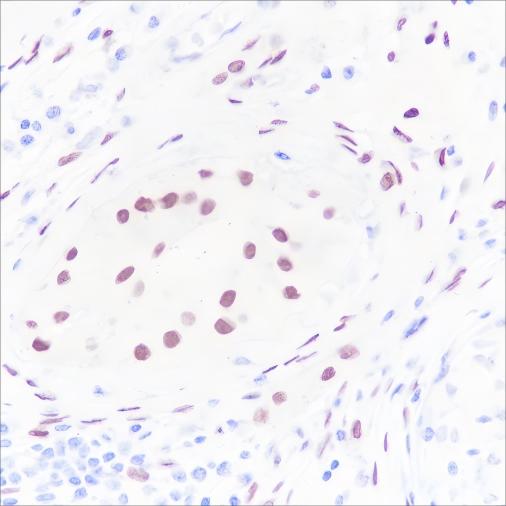 Recombinant Androgen Receptor (CT) Monoclonal Antibody - small - 3