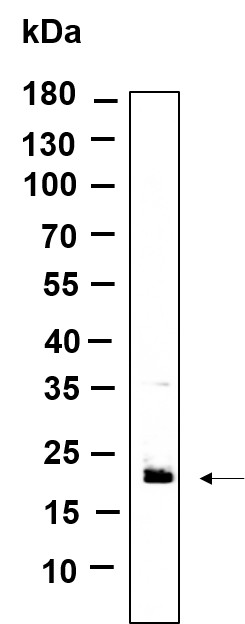 Recombinant RAB7B Monoclonal Antibody-searchlist-1