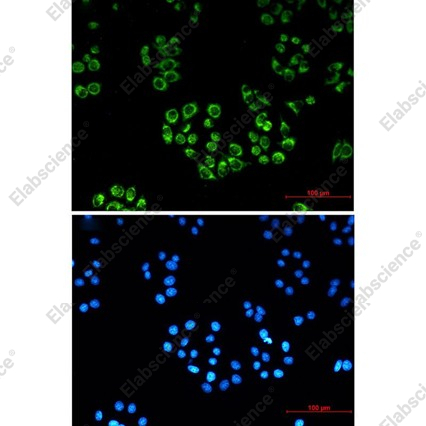 Recombinant FH Monoclonal Antibody - 3