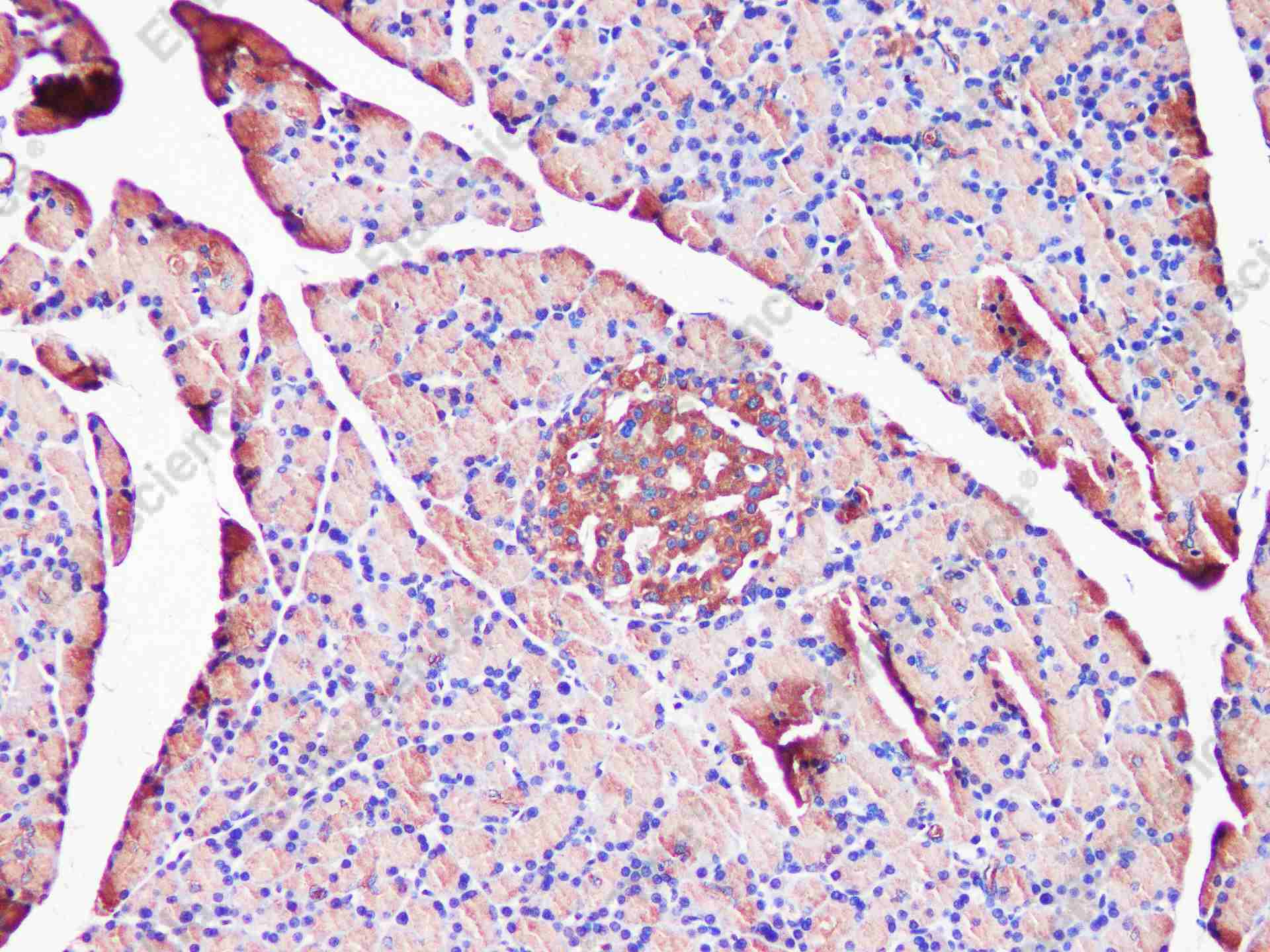 EEF2 Polyclonal Antibody - 5