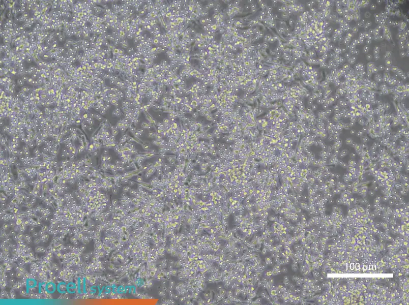 Human Peripheral Blood Immature Dendritic Cell Complete Medium - 2