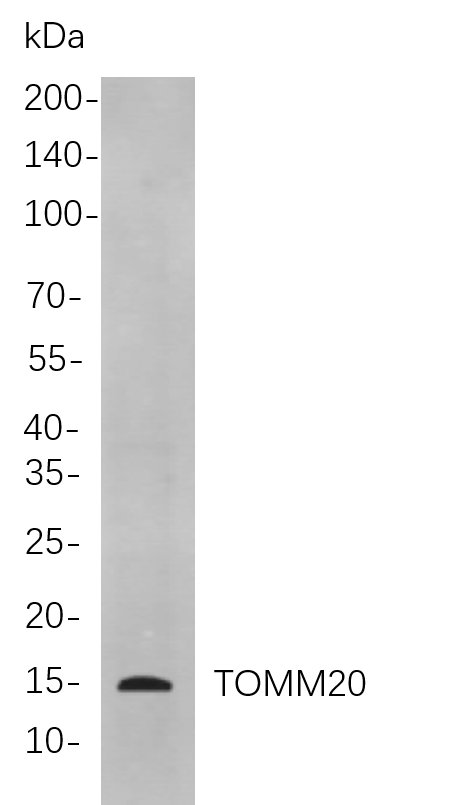 Recombinant TOMM20 Monoclonal Antibody-searchlist-1