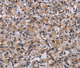 IPO4 Polyclonal Antibody - 3