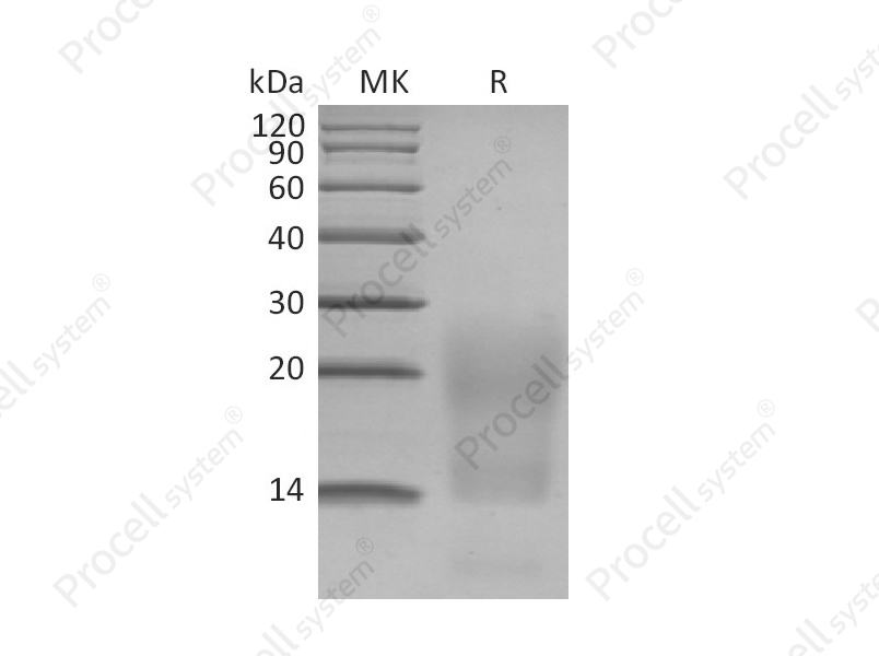 TNFRSF17/BCMA/CD269 (C-6His), Human, Recombinant