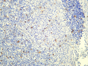 Recombinant Integrin αE Monoclonal Antibody - 1