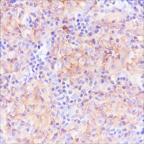 Recombinant CD40 Monoclonal Antibody - 2