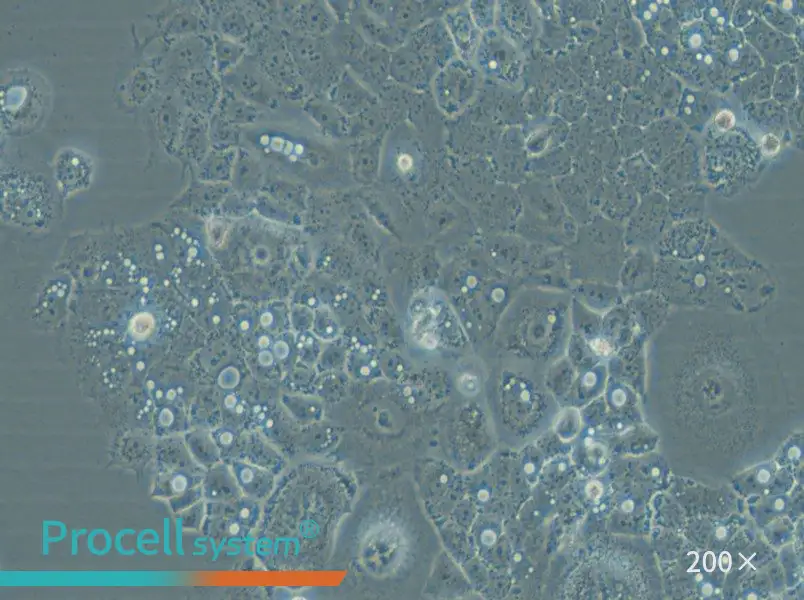 HARA-B Cell Complete Medium - small - 4